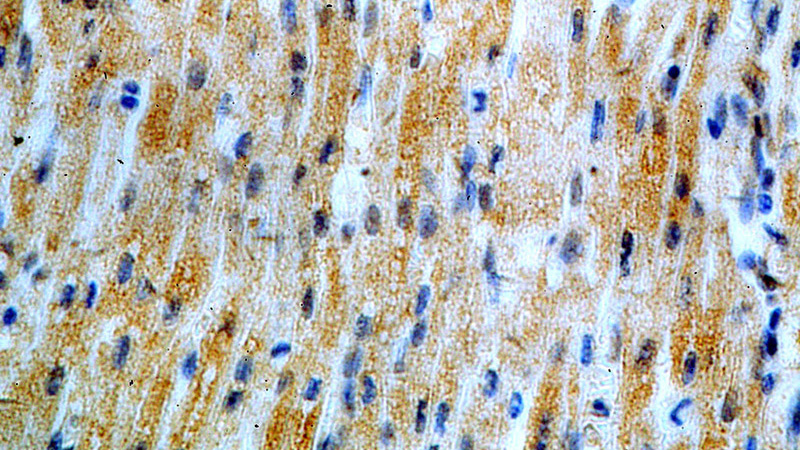 Immunohistochemical of paraffin-embedded human heart using Catalog No:116195(TMEM70 antibody) at dilution of 1:100 (under 40x lens)