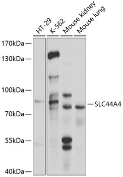Western blot - SLC44A4 Polyclonal Antibody 