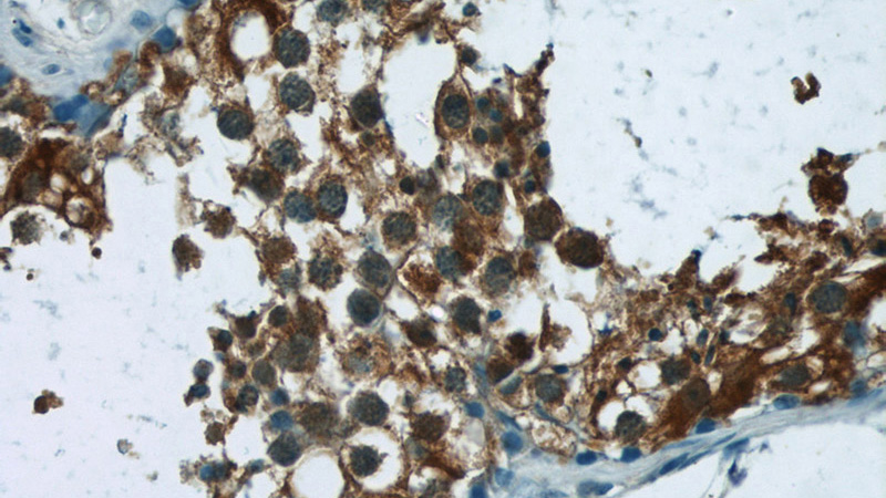 Immunohistochemistry of paraffin-embedded human testis tissue slide using Catalog No:114743(RNF151 Antibody) at dilution of 1:50 (under 40x lens)