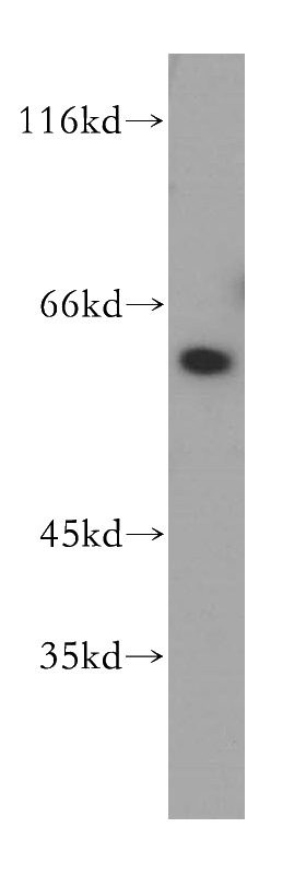 K-562 cells were subjected to SDS PAGE followed by western blot with Catalog No:110049(DOK1 antibody) at dilution of 1:400