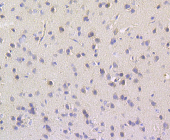 Fig5: Immunohistochemical analysis of paraffin-embedded mouse brain tissue using anti-TESPA1 antibody. Counter stained with hematoxylin.
