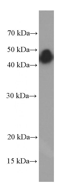 fetal human brain tissue were subjected to SDS PAGE followed by western blot with Catalog No:107328(NESP55,GNAS Antibody) at dilution of 1:2000