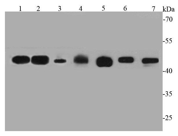 Fig1: Western blot analysis of GAP43 on different cell lysates using anti-GAP43 antibody at 1/1000 dilution.; Positive control:; Lane 1: Rat brain; Lane 2: Mouse brain; Lane 3: Mouse heart; Lane 4: Human skeletal muscle; Lane 5: N2A; Lane 6: A172; Lane 7: Human heart