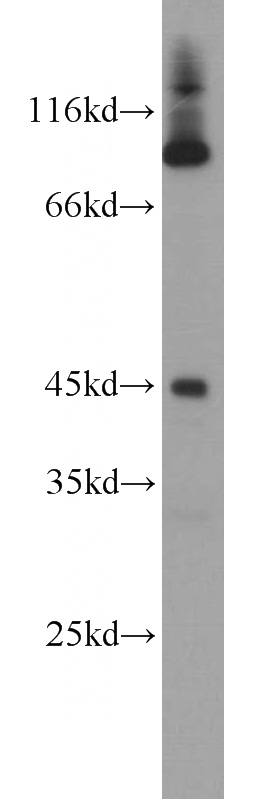 L02 cells were subjected to SDS PAGE followed by western blot with Catalog No:112078(KLF13 antibody) at dilution of 1:1000