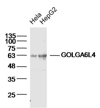 Fig1: Sample:; MCF-7 (Human)Cell Lysate at 40 ug; Hela(Human) Cell Lysate at 40 ug; Primary: Anti-GALNT10(bs-13270R)at 1/300 dilution; Secondary: IRDye800CW Goat Anti-RabbitIgG at 1/20000 dilution; Predicted band size: 69kD; Observed band size: 63kD