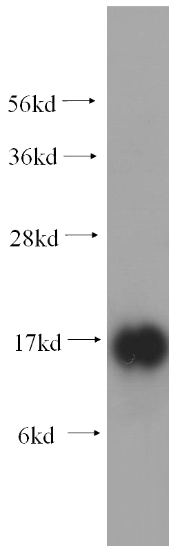 human testis tissue were subjected to SDS PAGE followed by western blot with Catalog No:114832(RPS19 antibody) at dilution of 1:400