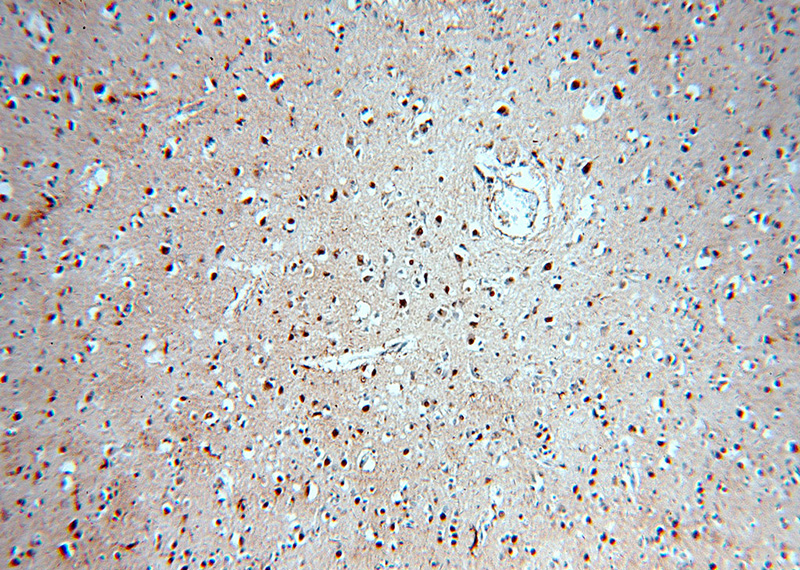 Immunohistochemical of paraffin-embedded human brain using Catalog No:115520(SOX8 antibody) at dilution of 1:50 (under 10x lens)