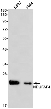 Western blot detection of NDUFAF4 in K562,Hela cell lysates using NDUFAF4 Rabbit pAb(1:1000 diluted).Predicted band size:20kDa.Observed band size:20kDa.