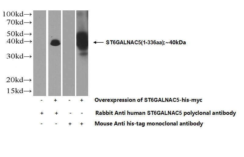 Transfected HEK-293 cells were subjected to SDS PAGE followed by western blot with Catalog No:115630(ST6GALNAC5 Antibody) at dilution of 1:1000