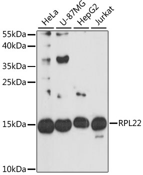 Western blot - RPL22 Polyclonal Antibody 