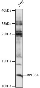 Western blot - RPL36A Polyclonal Antibody 