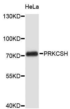 Western blot - PRKCSH Polyclonal Antibody 