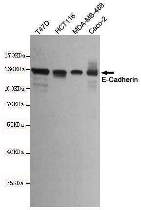 Western blot detection of E-Cadherin in T47D,HCT116,MDA-MB-468 and Caco-2 cell lysates using E-Cadherin mouse mAb(dilution 1:2000).Predicted band size:135kDa.Observed band size:135kDa.