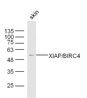 Fig4: Sample:Skin(Mouse) Lysate at 40 ug; Primary: Anti-XIAP/BIRC4 at 1/300 dilution; Secondary: IRDye800CW Goat Anti-Rabbit IgG at 1/20000 dilution; Predicted band size: 55 kD; Observed band size: 53 kD