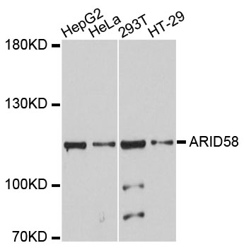 Western blot - ARID5B Polyclonal Antibody 