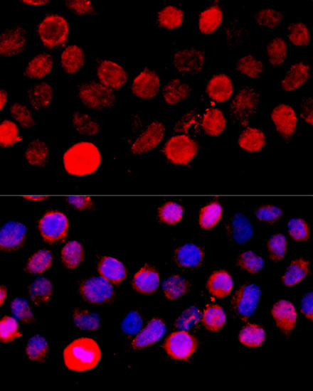 Immunofluorescence - BAZ1A Polyclonal Antibody 