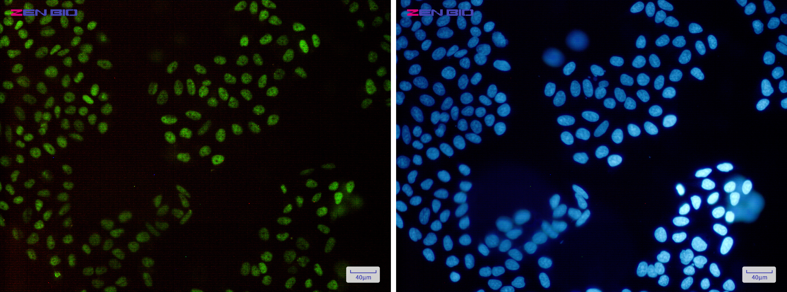 Immunocytochemistry of HLTF(green) in Hela cells using HLTF Rabbit pAb at dilution 1/50, and DAPI(blue)