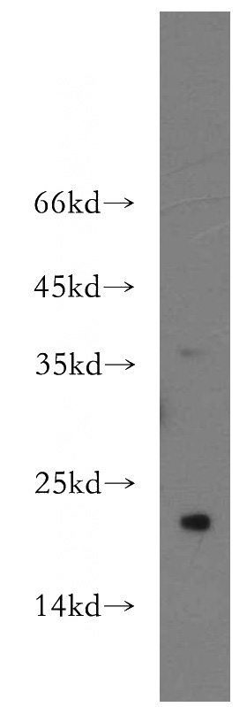 human testis tissue were subjected to SDS PAGE followed by western blot with Catalog No:115541(SPANXC antibody) at dilution of 1:300