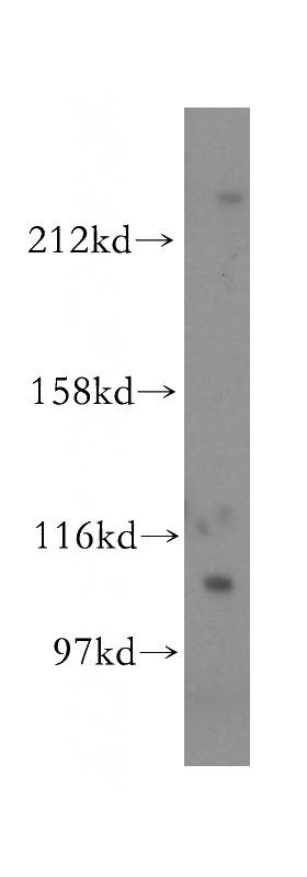 mouse brain tissue were subjected to SDS PAGE followed by western blot with Catalog No:111586(Icam1 antibody) at dilution of 1:4000