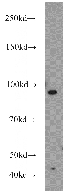 HeLa cells were subjected to SDS PAGE followed by western blot with Catalog No:112459(MALT1 antibody) at dilution of 1:600