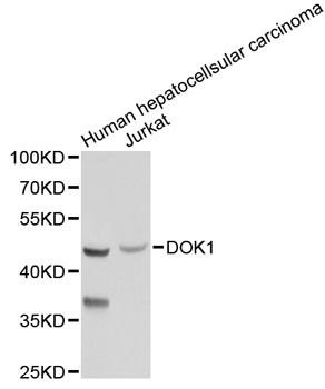 Western blot - DOK1 Polyclonal Antibody 