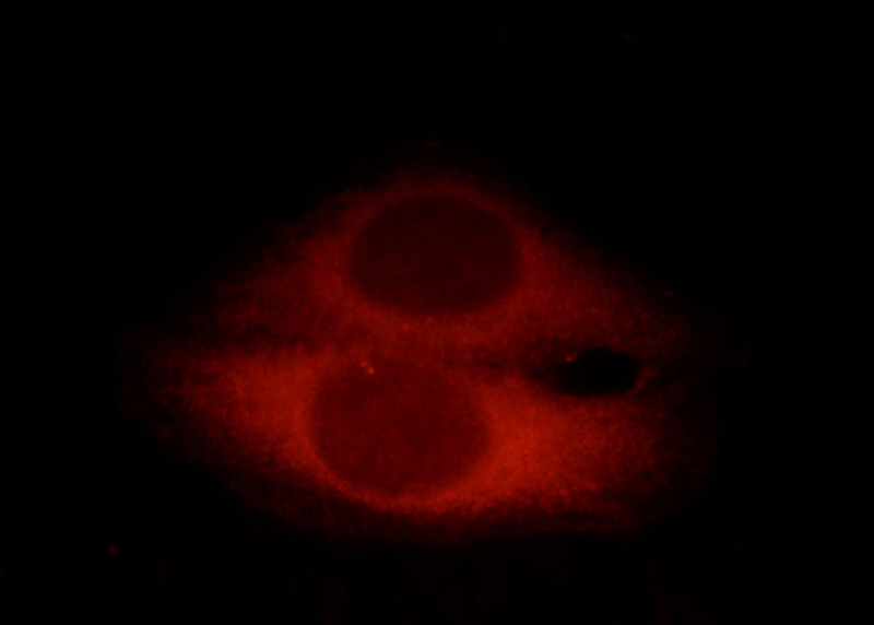 Immunofluorescent analysis of HepG2 cells, using CC2D1A antibody Catalog No:108951 at 1:50 dilution and Rhodamine-labeled goat anti-rabbit IgG (red).