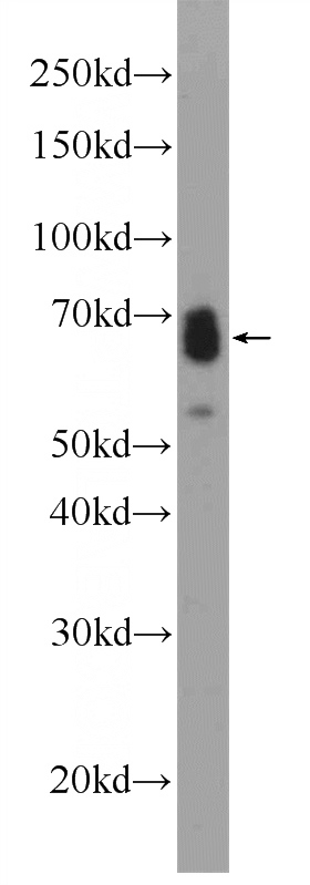 mouse spleen tissue were subjected to SDS PAGE followed by western blot with Catalog No:108211(ASB14 Antibody) at dilution of 1:600