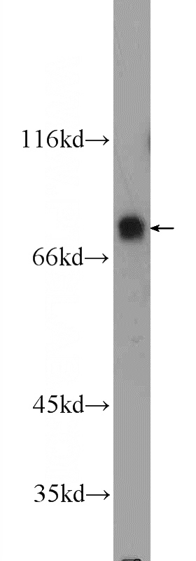 Jurkat cells were subjected to SDS PAGE followed by western blot with Catalog No:115525(SP2 Antibody) at dilution of 1:300