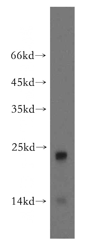human testis tissue were subjected to SDS PAGE followed by western blot with Catalog No:116652(UBL4B antibody) at dilution of 1:500