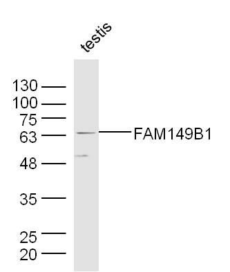 Fig1: Sample:; Testis (Mouse) Lysate at 40 ug; Primary: Anti-FAM149B1 at 1/500 dilution; Secondary: IRDye800CW Goat Anti-Rabbit IgG at 1/20000 dilution; Predicted band size: 65 kD; Observed band size: 65 kD