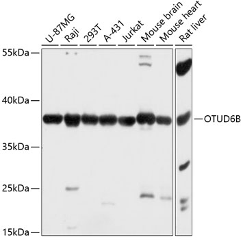 Western blot - OTUD6B Polyclonal Antibody 