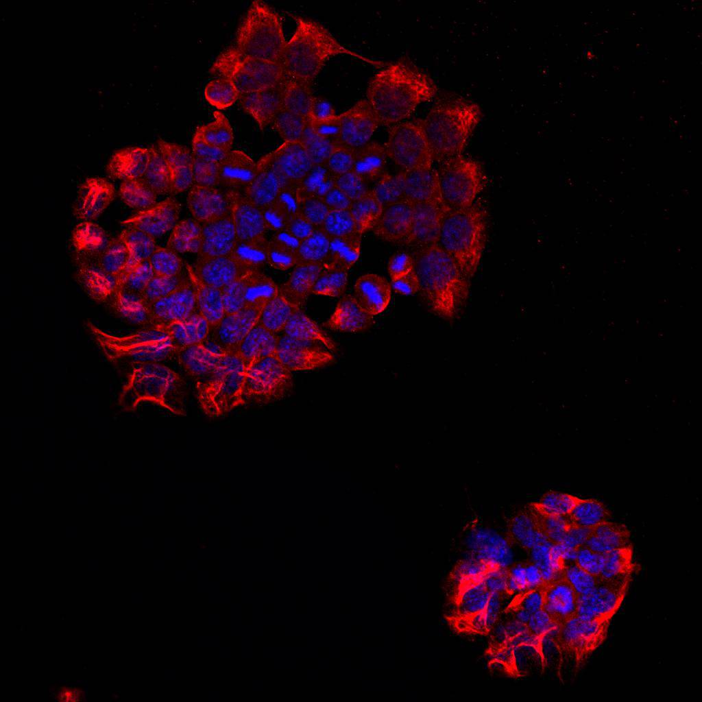 Fig1: ICC staining PTPRB in F9 cells (red). Cells were fixed in paraformaldehyde, permeabilised with 0.25% Triton X100/PBS and counterstained with DAPI in order to highlight the nucleus (blue).