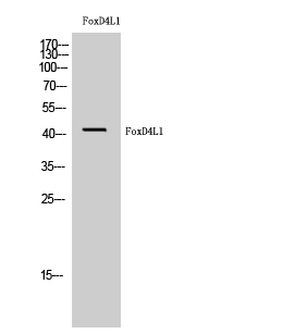 Fig1:; Western Blot analysis of HuvEc cells using FoxD4L1 Polyclonal Antibody cells nucleus extracted by Minute TM Cytoplasmic and Nuclear Fractionation kit (SC-003,Inventbiotech,MN,USA).