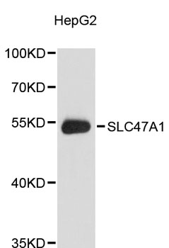 Western blot - SLC47A1 Polyclonal Antibody 