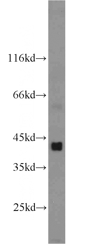 mouse skeletal muscle tissue were subjected to SDS PAGE followed by western blot with Catalog No:109918(DHH antibody) at dilution of 1:1000