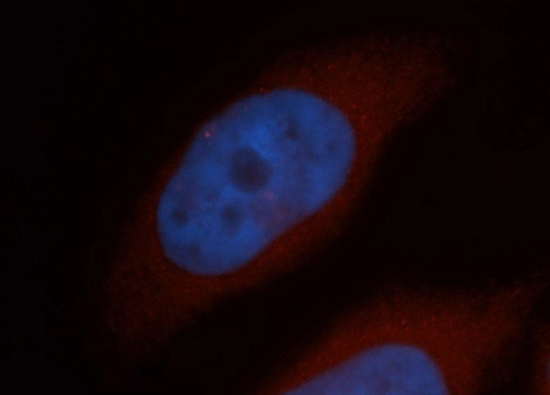Immunofluorescent analysis of Hela cells, using RABEP2 antibody Catalog No:114494 at 1:50 dilution and Rhodamine-labeled goat anti-rabbit IgG (red). Blue pseudocolor = DAPI (fluorescent DNA dye).