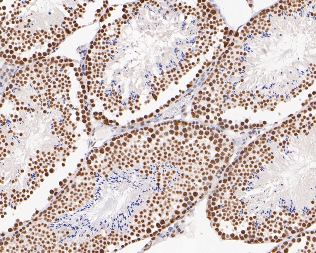 Fig10:; Immunohistochemical analysis of paraffin-embedded mouse testis tissue using anti-GATAD2A antibody. The section was pre-treated using heat mediated antigen retrieval with sodium citrate buffer (pH 6.0) for 20 minutes. The tissues were blocked in 5% BSA for 30 minutes at room temperature, washed with ddH; 2; O and PBS, and then probed with the primary antibody ( 1/200) for 30 minutes at room temperature. The detection was performed using an HRP conjugated compact polymer system. DAB was used as the chromogen. Tissues were counterstained with hematoxylin and mounted with DPX.