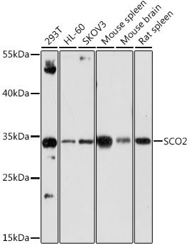 Western blot - SCO2 Polyclonal Antibody 