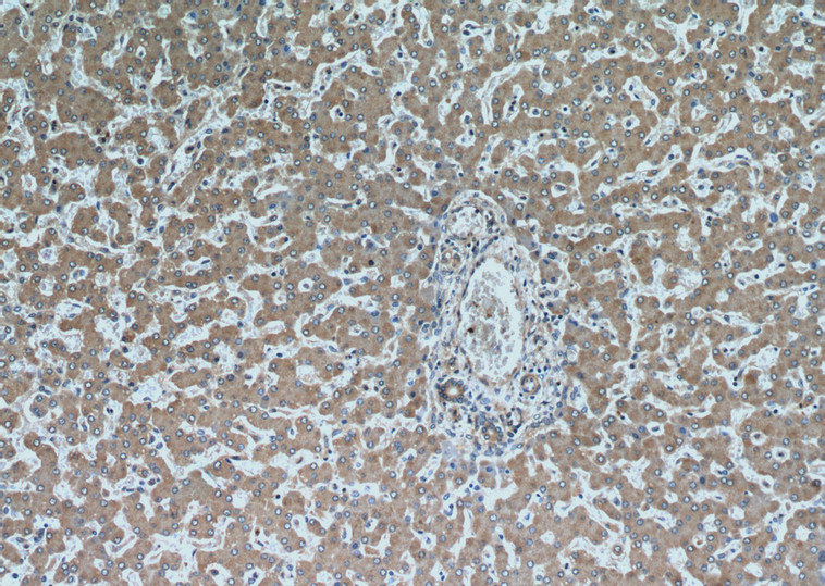 Immunohistochemical of paraffin-embedded human liver using Catalog No:115067(SAR1B antibody) at dilution of 1:50 (under 10x lens)