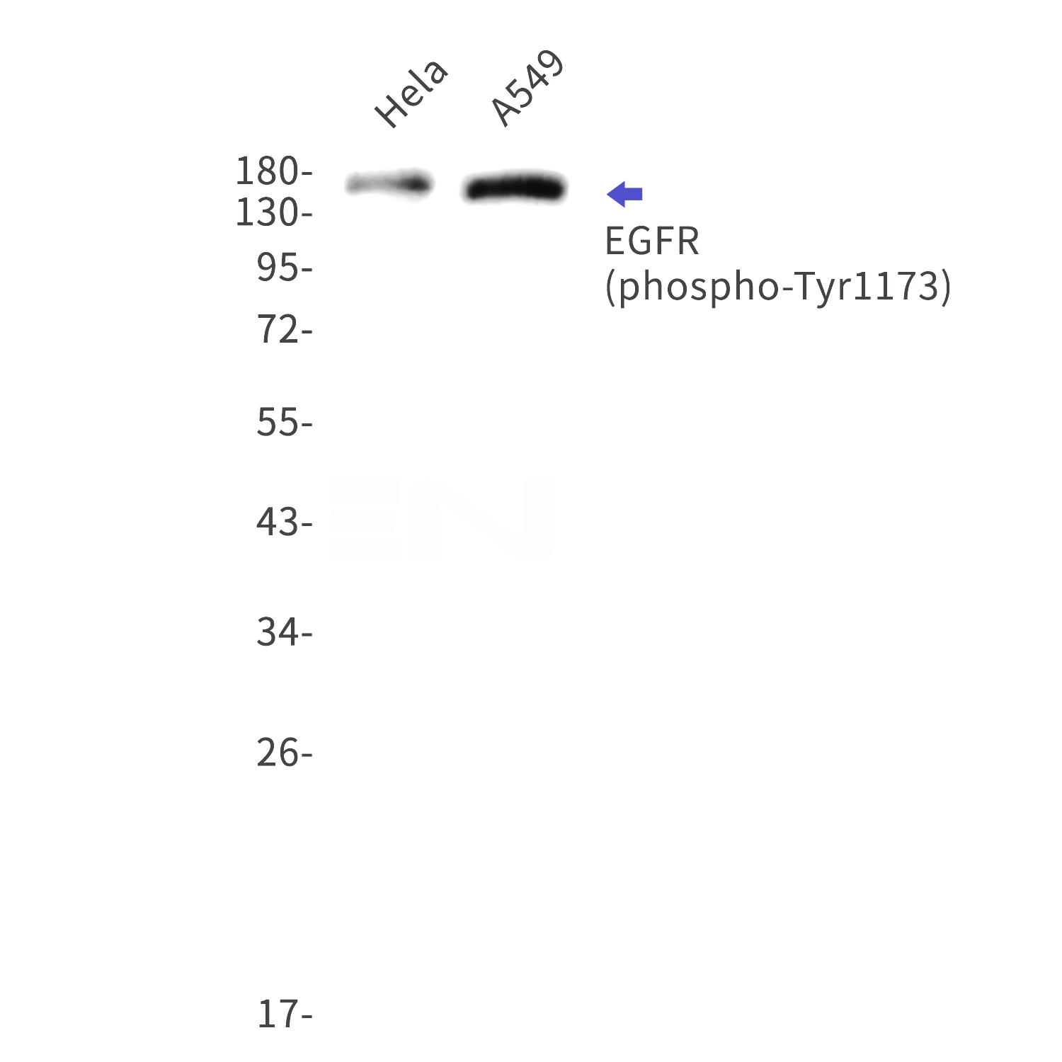 Western blot detection of phospho-EGFR (Tyr1173) in Hela,A549 cell lysates using phospho-EGFR (Tyr1173) Rabbit mAb(1:1000 diluted).Predicted band size:134kDa.Observed band size:175kDa.