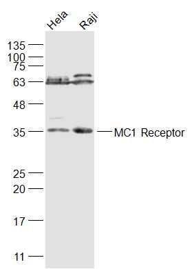 Fig1: Sample:; Hela(Human) Cell Lysate at 30 ug; Raji(Human) Cell Lysate at 30 ug; Primary: Anti-MC1 Receptor at 1/1000 dilution; Secondary: IRDye800CW Goat Anti-Rabbit IgG at 1/20000 dilution; Predicted band size: 35 kD; Observed band size: 35 kD
