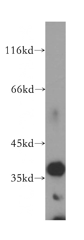 human brain tissue were subjected to SDS PAGE followed by western blot with Catalog No:112774(MTG1 antibody) at dilution of 1:300