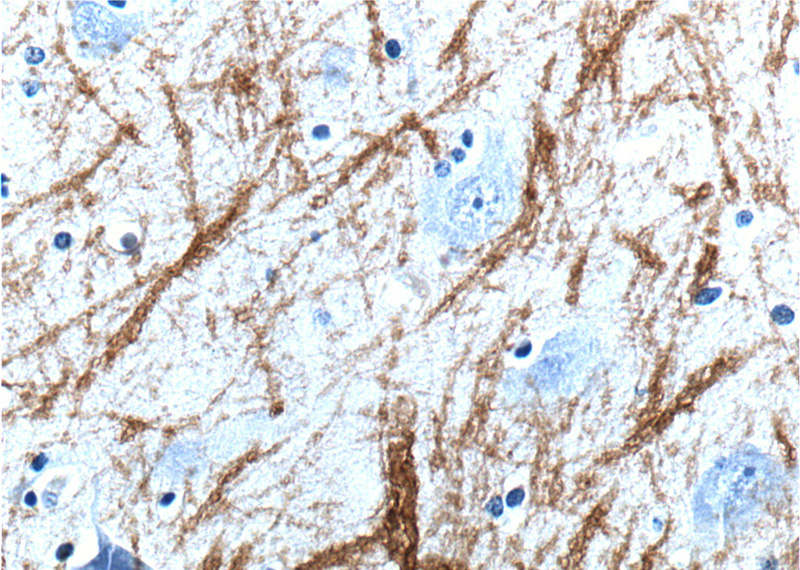 Immunohistochemistry of paraffin-embedded human brain tissue slide using Catalog No:112923(MBP Antibody) at dilution of 1:200 (under 40x lens).