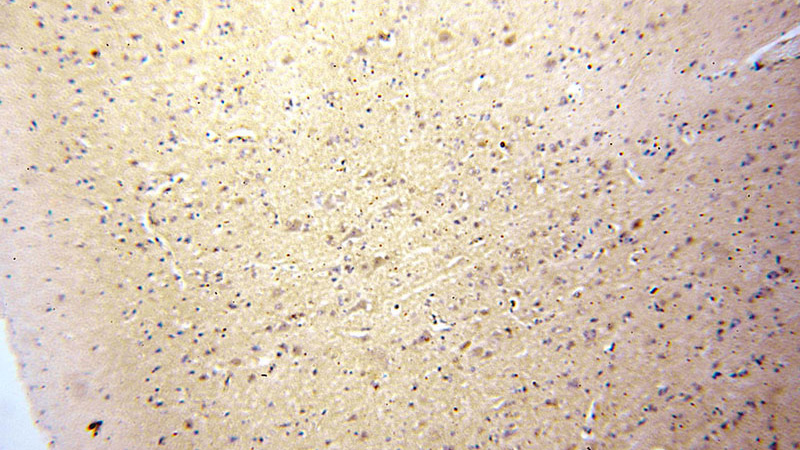 Immunohistochemical of paraffin-embedded human brain using Catalog No:112564(MCTP2 antibody) at dilution of 1:100 (under 10x lens)