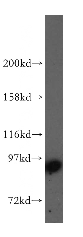 NIH/3T3 cells were subjected to SDS PAGE followed by western blot with Catalog No:115692(STAT5A antibody) at dilution of 1:400