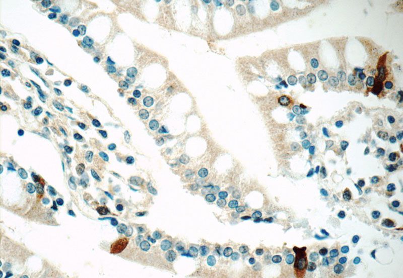 Immunohistochemistry of paraffin-embedded human small intestine tissue slide using Catalog No:109870(DAX-1 Antibody) at dilution of 1:50 (under 40x lens)