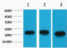 Western blot analysis of 1) MCF7, 2) Rat Kidney Tissue, 3) Mouse Brain Tissue, diluted at 1:2000.