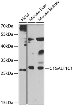 Western blot - C1GALT1C1 Polyclonal Antibody 