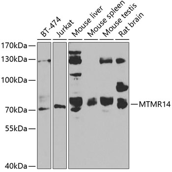 Western blot - MTMR14 Polyclonal Antibody 