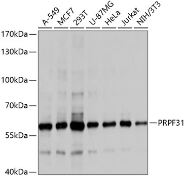 Western blot - PRPF31 Polyclonal Antibody 